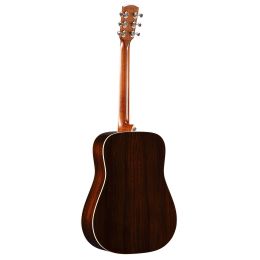 alvarez-guitars_md70ebg-masterworks-imagen-2-thumb